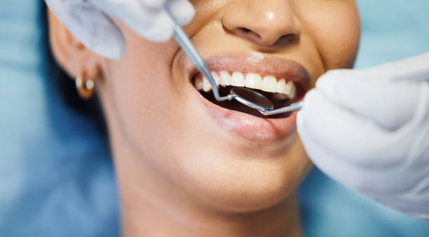 Best Emergency Root Canal Treatment in New Berlin, IL
