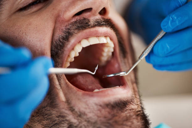 Best Pediatric Emergency Dentist in New Berlin, IL