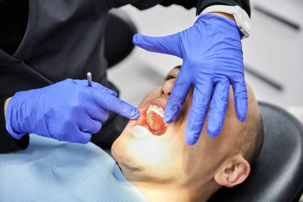 Best Emergency Dental Care for Abscessed Tooth in New Berlin, IL