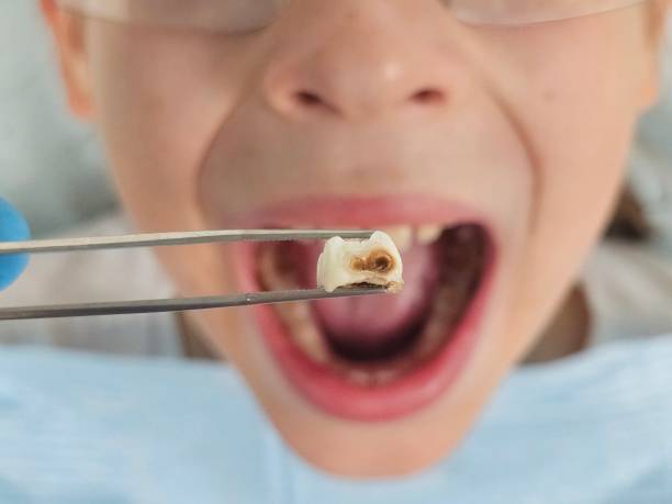 Best Emergency Dental Services for Seniors in New Berlin, IL