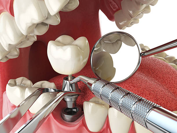 Best Pediatric Emergency Dentist in New Berlin, IL
