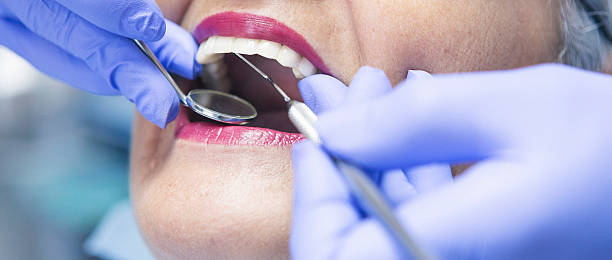 Best Emergency Dental Extractions in New Berlin, IL