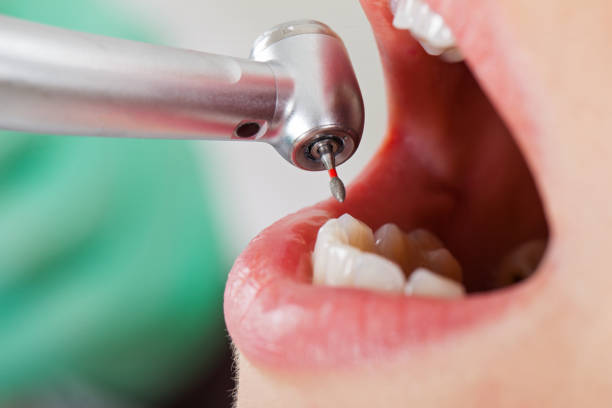 Best Weekend Emergency Dentist in New Berlin, IL